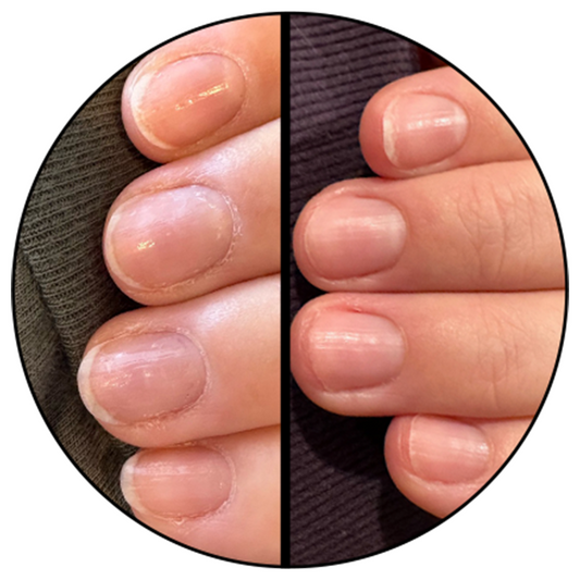 Cuticle Oil