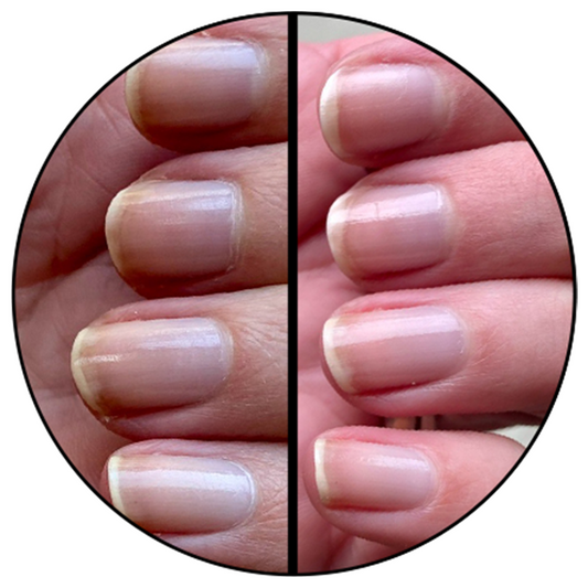 Nail Hardener
