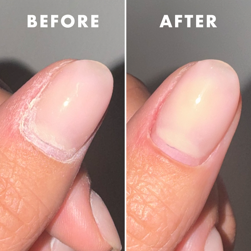 Cuticle Buffer